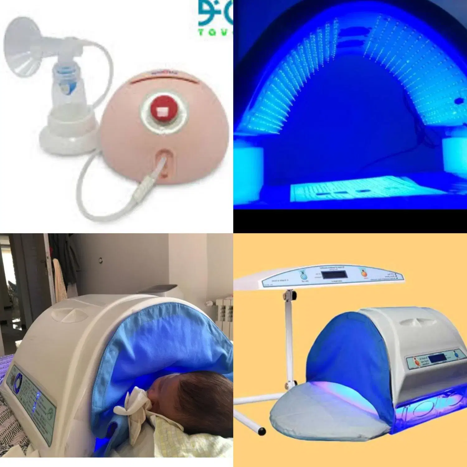 اجاره دستگاه زردی نوزاد در منزل + مشاوره تخصصی